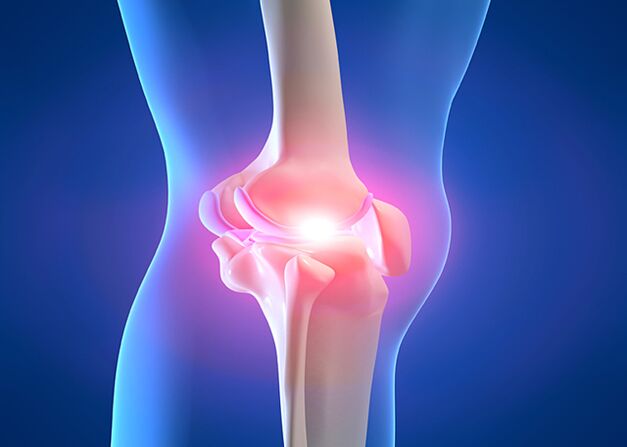 Joint pain due to knee osteoarthritis