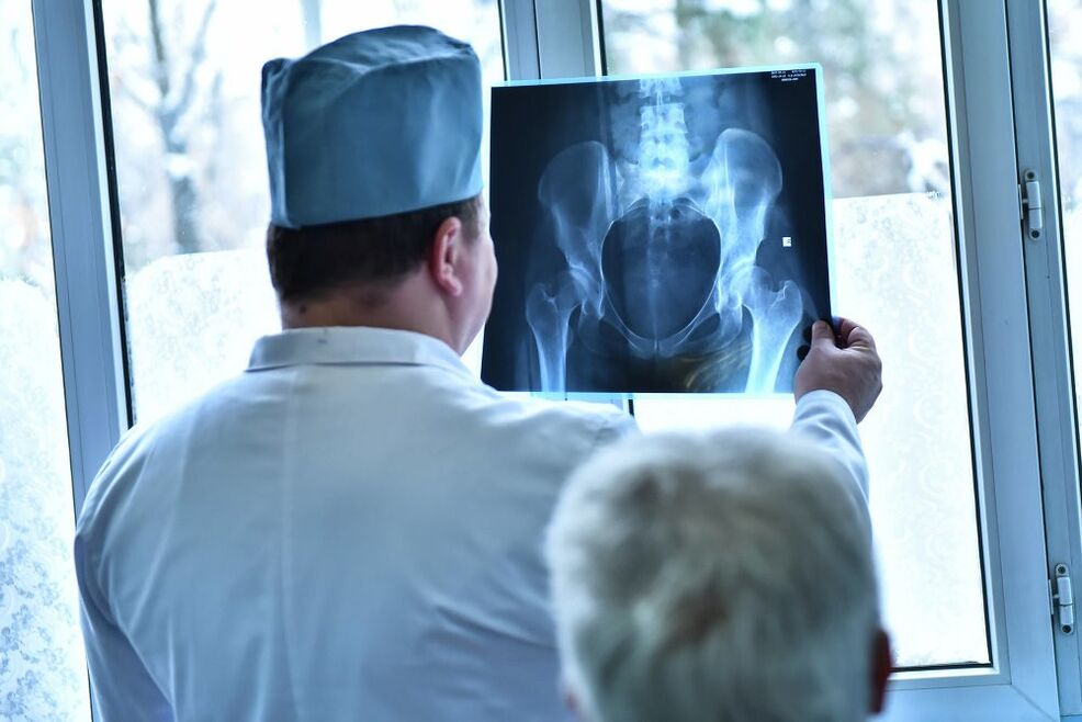 The doctor looks at a picture of a hip joint with osteoarthritis