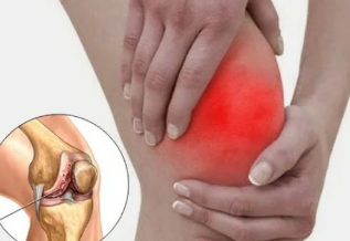 What happens in case of Arthritis